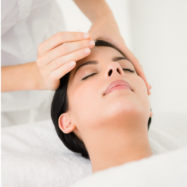 Woman receiving holistic acupuncture treatment for wellness and stress relief at Balance Naturopathic & Acupuncture.