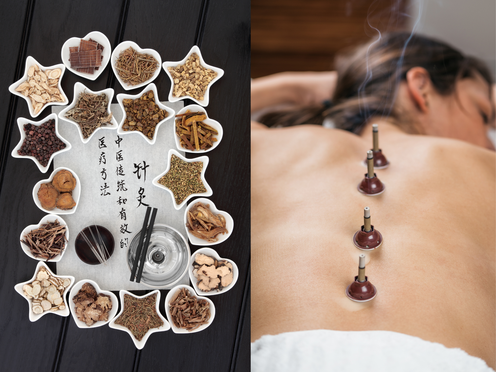 Traditional Chinese medicine herbs and cupping therapy used in integrative treatments at Balance Naturopathic & Acupuncture.